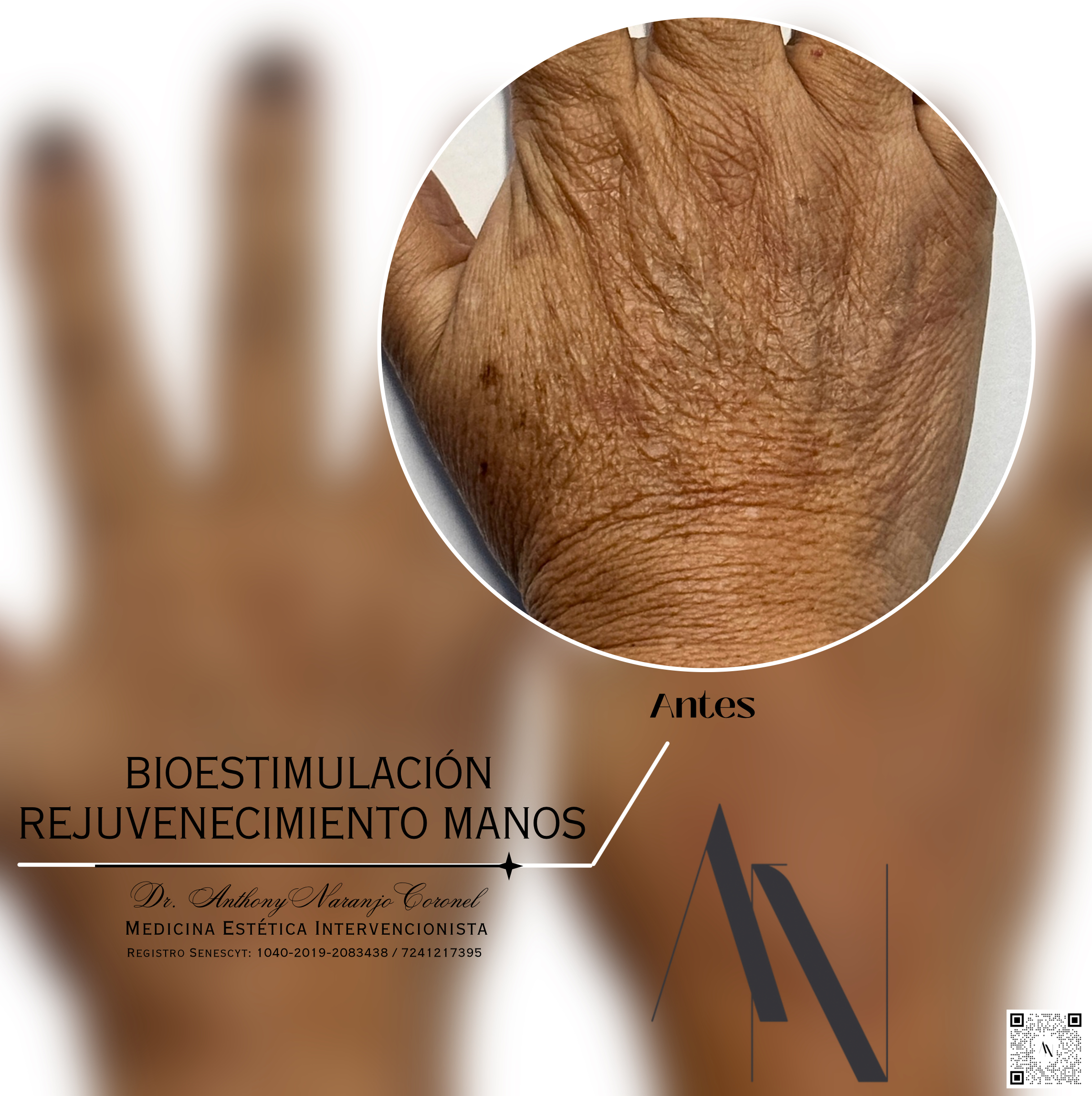 bioestimulacion