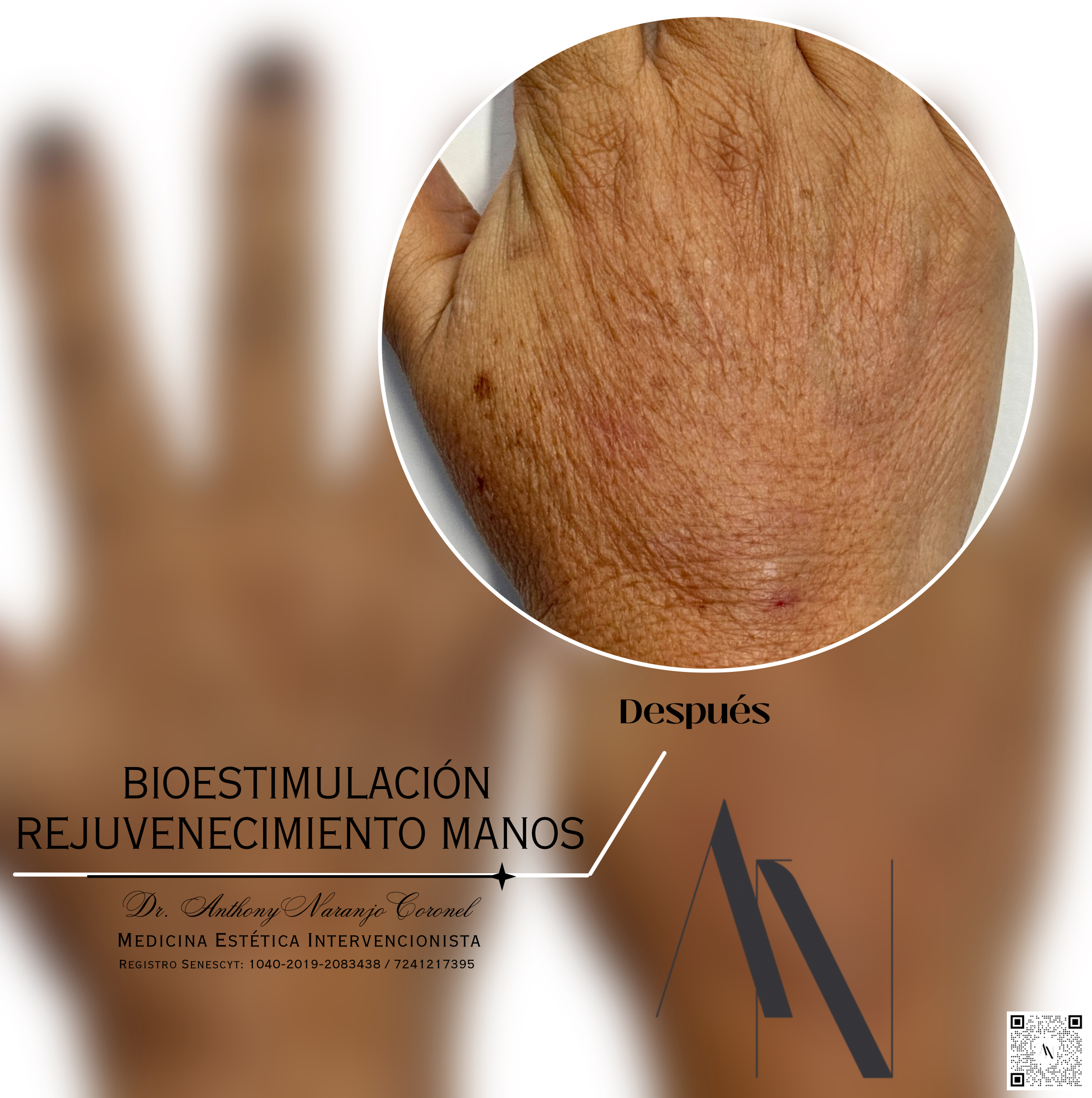 bioestimulacion