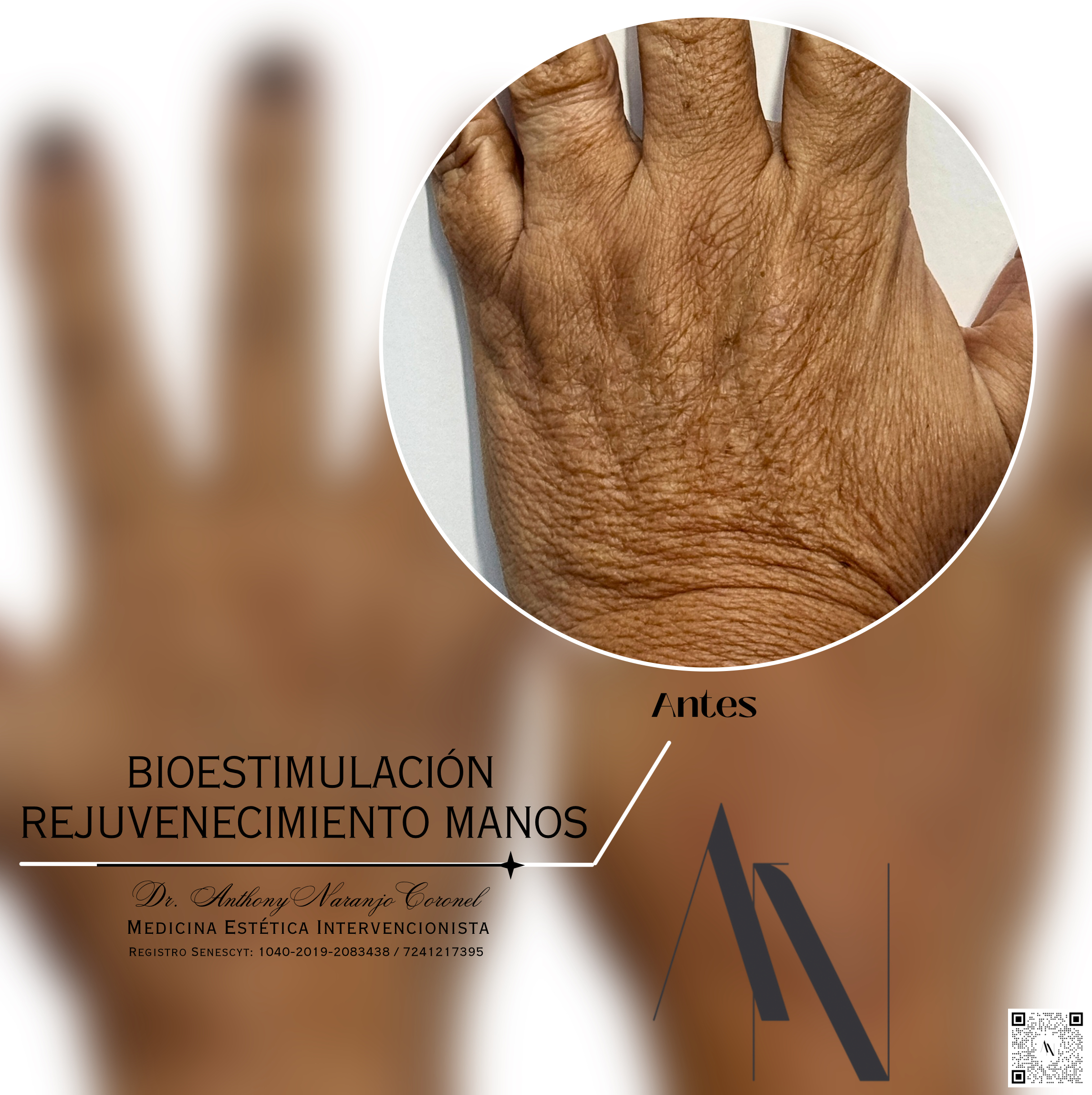 bioestimulacion