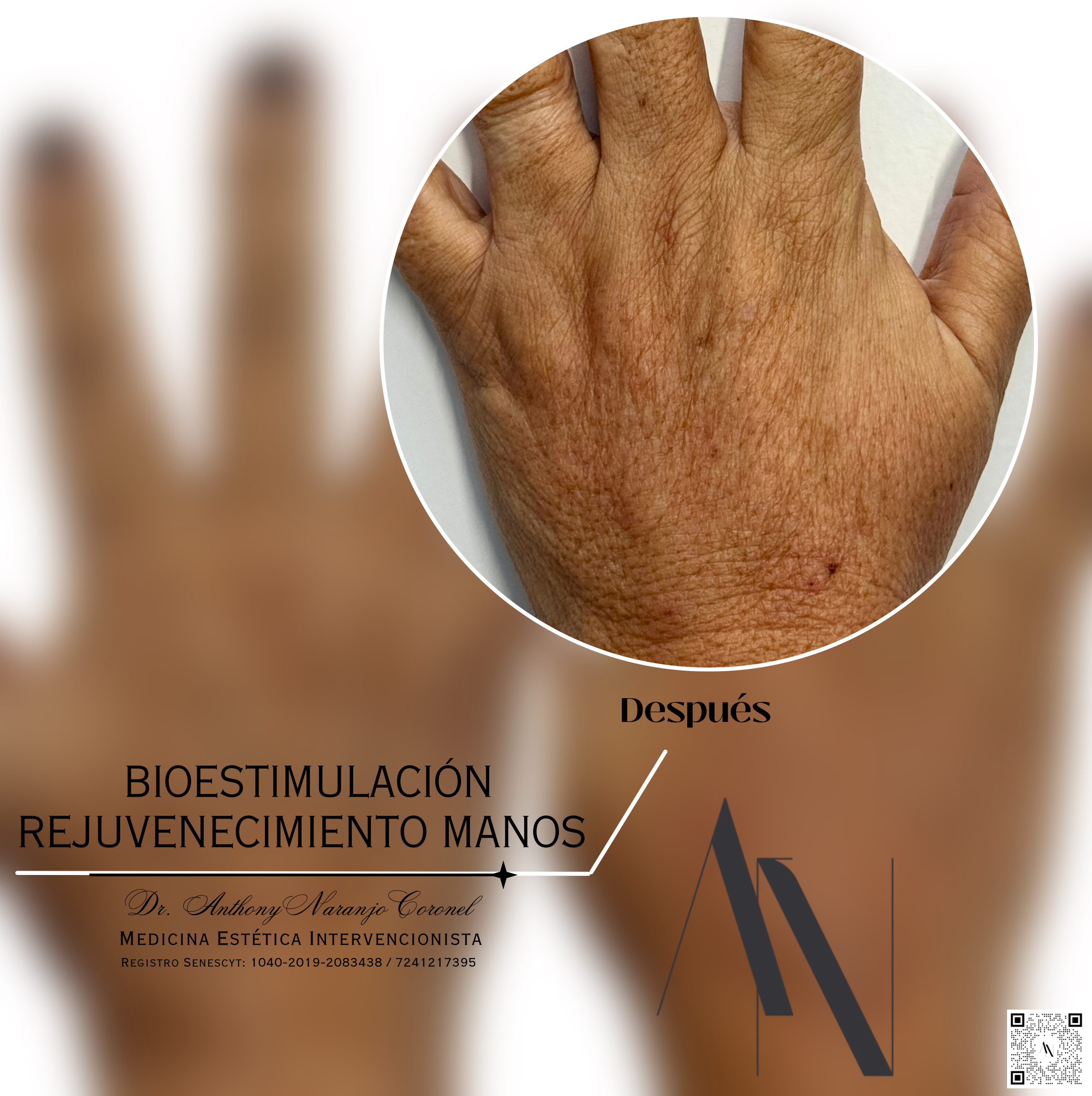 bioestimulacion