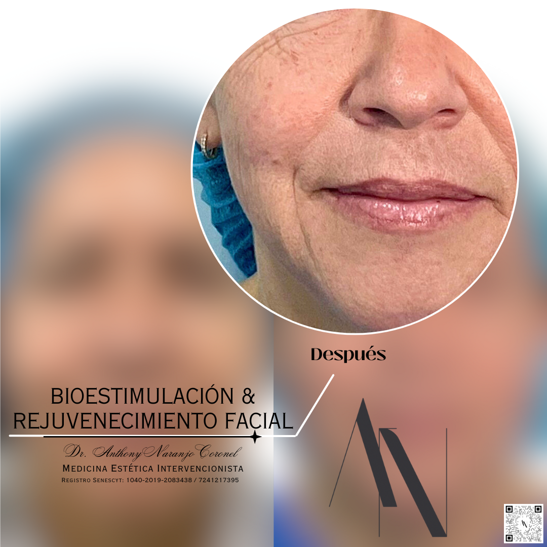 bioestimulacion